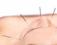 Acupuncture, Alternative Therapy